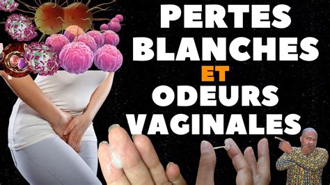 perte blanche cremeuse|Pertes vaginales blanches, quand sinquiéter et quand。